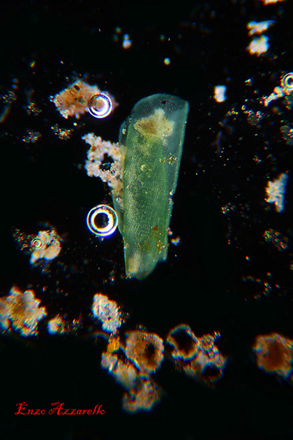 Merismopedia - campo scuro - Rheinberg - campo chiaro